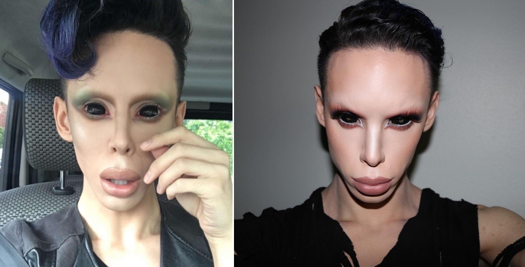 Jovem faz plásticas para ficar parecido com alienígena