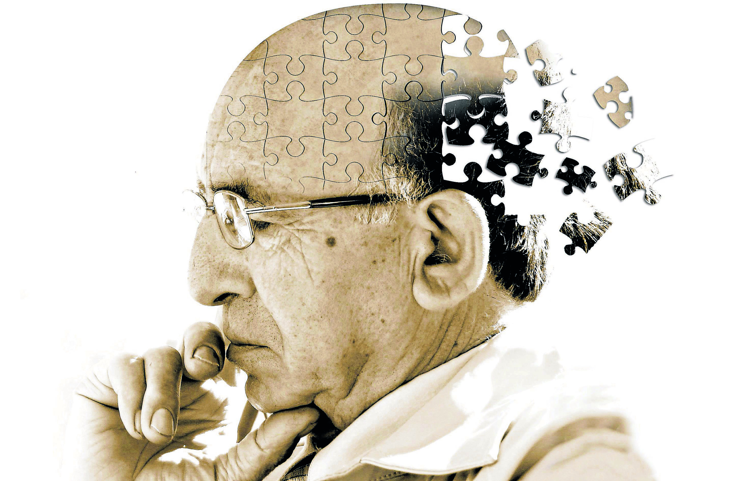 Cientistas descobrem como produzir hormônios que evitam o Mal de Alzheimer