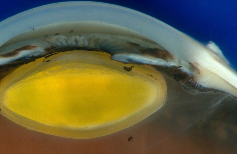 Mulher é a primeira a ter a visão reparada por células-tronco reprogramadas