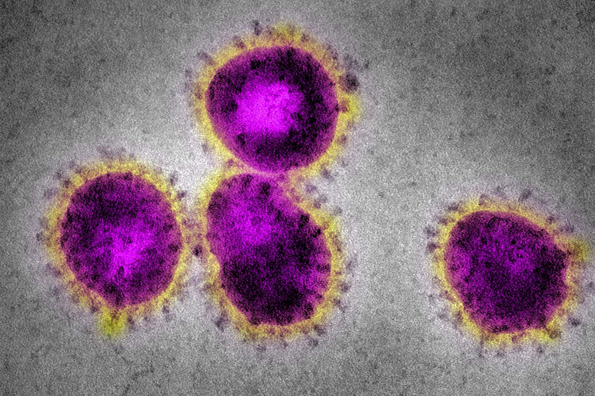 O Coronavírus pode infectar mais de uma vez a mesma pessoa?