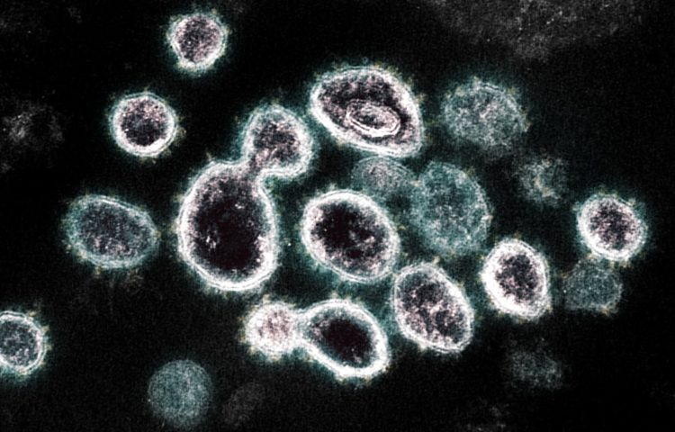 Japão registra 1.605 casos de COVID-19 na sexta-feira