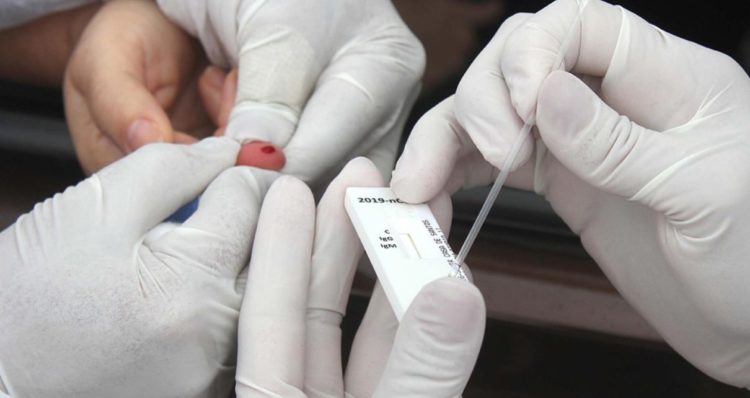 Kit de teste que detecta um dos sintomas do coronavírus é desenvolvido por Pesquisadores