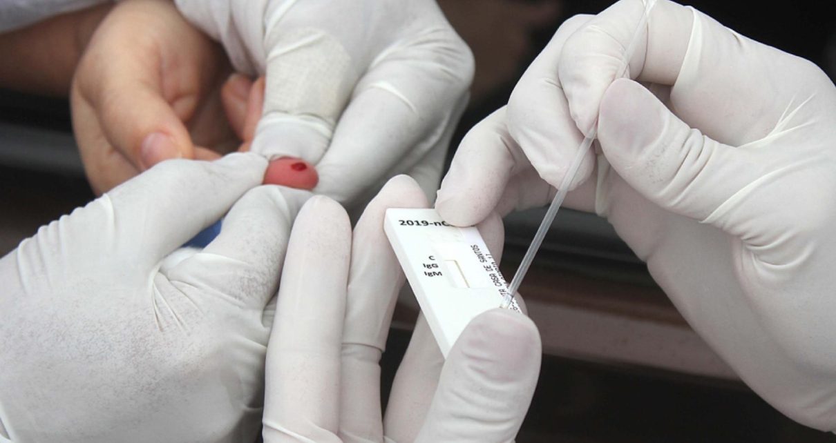 Kit de teste que detecta um dos sintomas do coronavírus é desenvolvido por Pesquisadores