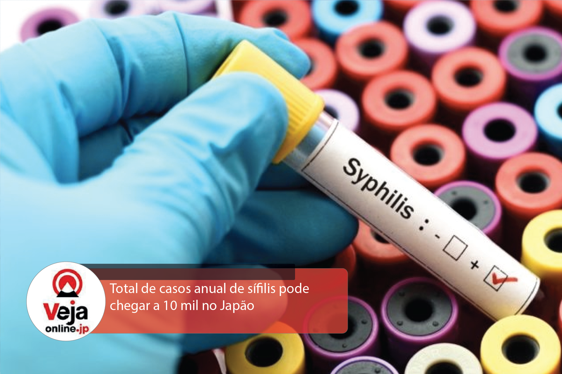 Casos de sífilis aumentam em ritmo acelerado no Japão
