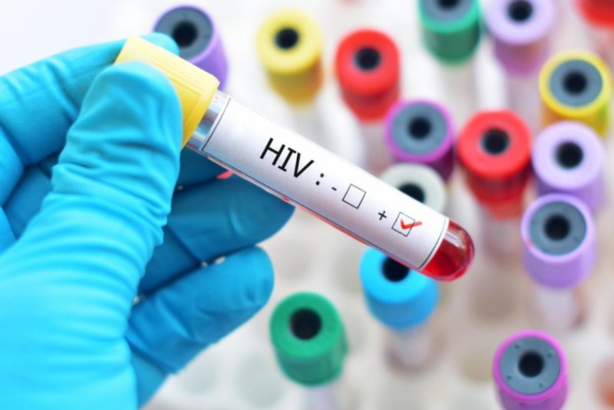 Taxa de diagnostico de AIDS em Okinawa ultrapassa 50% pela primeira vez em 20 anos
