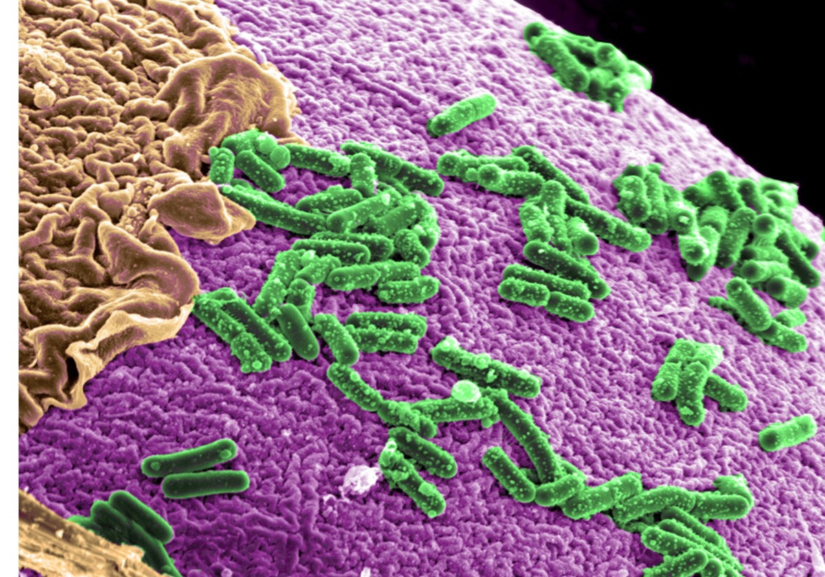 Pesquisadores descobrem bactérias intestinais capazes de proteger contra diabetes