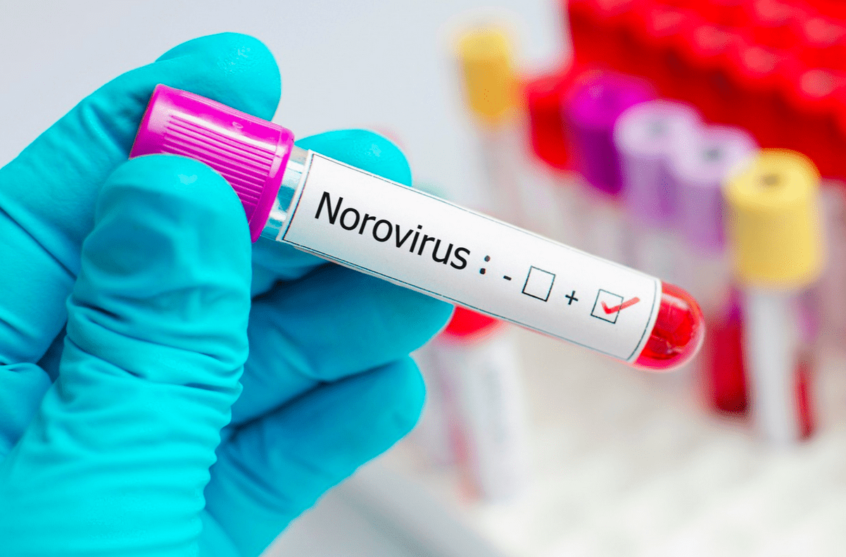 Norovírus contamina mais de 80 pessoas em escola primária