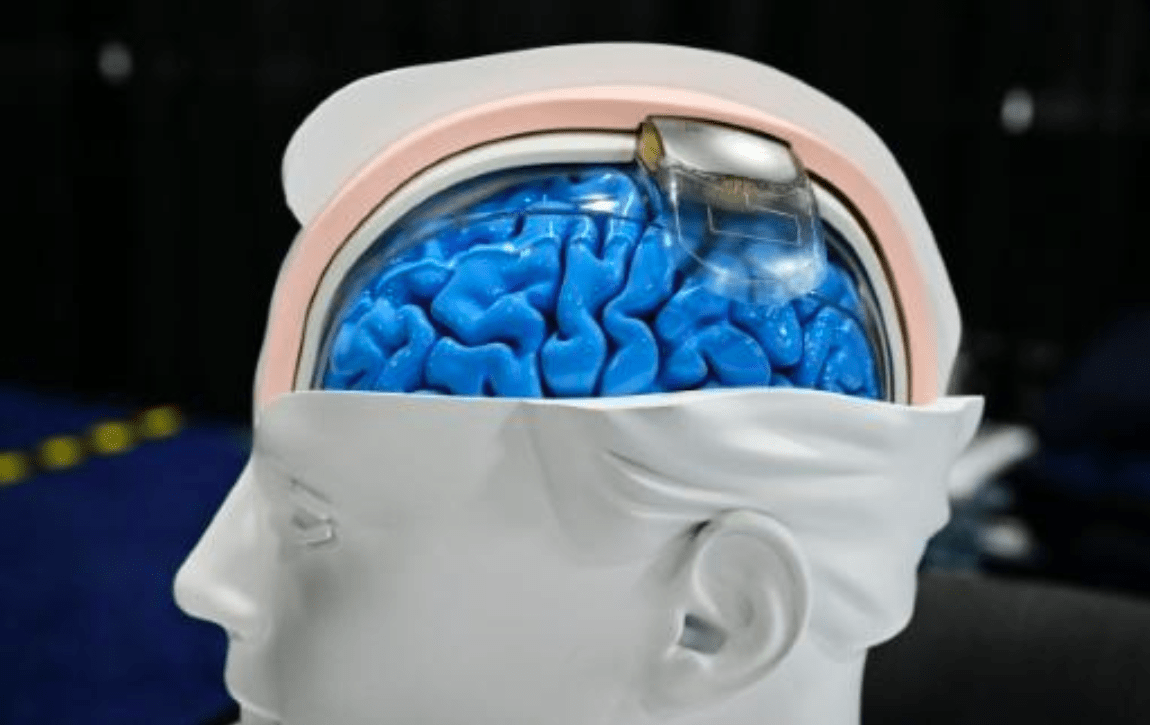 Neurotecnologia avança rapidamente, promete transformar a medicina e acende alertas éticos globais